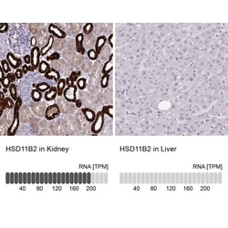 HSD11B2 Antibody, Novus Biologicals 0.1mL; Unlabeled:Antibodies, Polyclonal